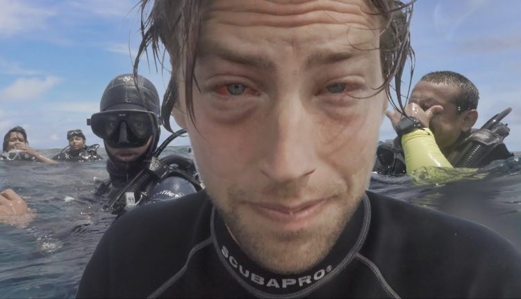 MY FIRST AMATEUR DIVE INJURY - MASK SQUEEZE | PADI SCUBA DIVE PONDICHERRY INDIA